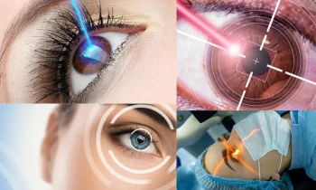 Lazerle Göz Çizdirme Nedir?