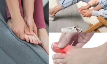 Başparmak Kireçlenmesi Yaşam Kalitesini Nasıl Etkiler